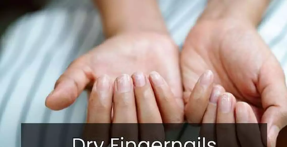 Dry Fingernails