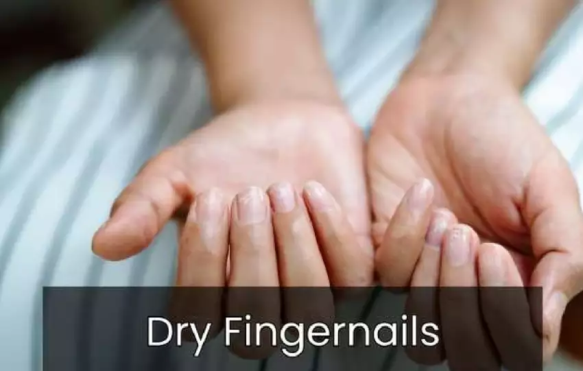 Dry Fingernails