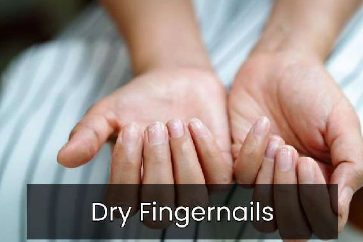 Dry Fingernails