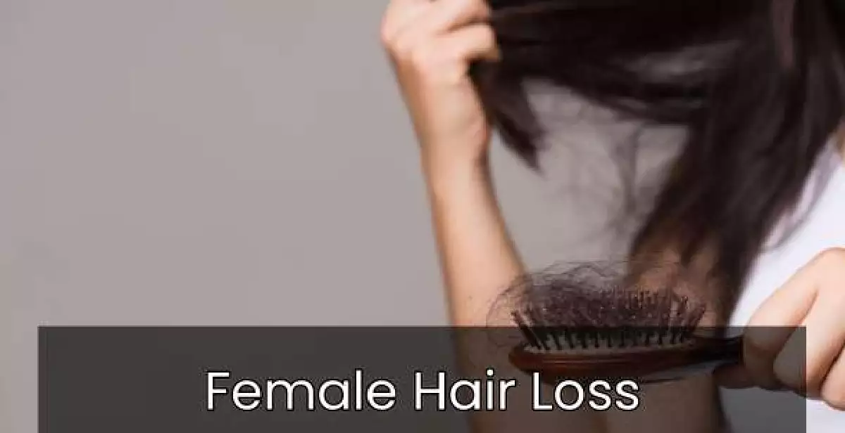 Female Hair Loss