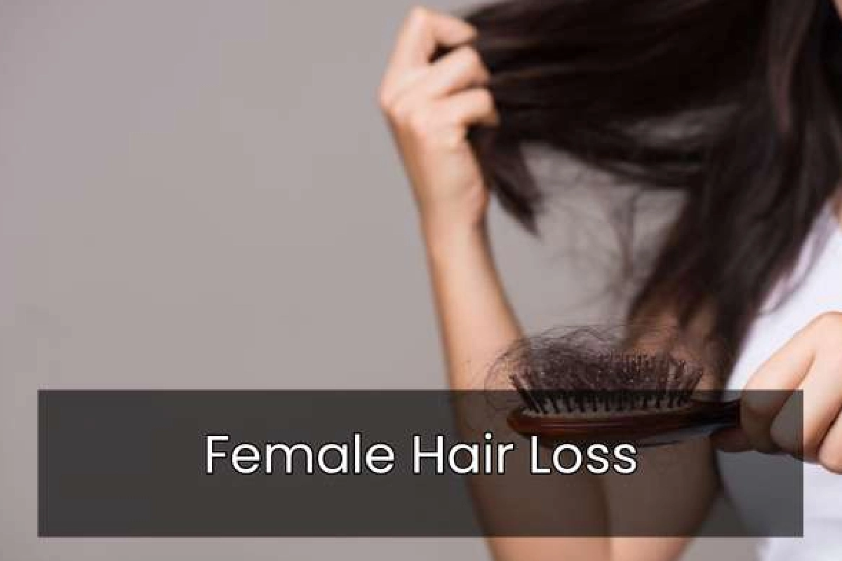 Female Hair Loss