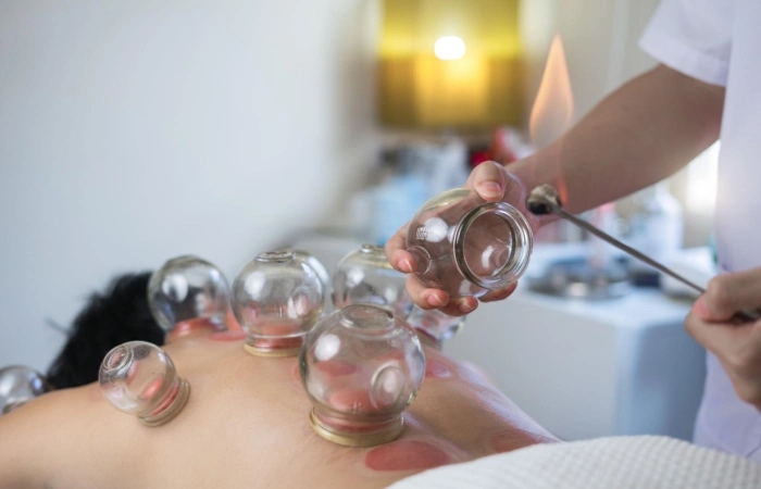 What is Cup Therapy - Does Cupping Remove Toxins?