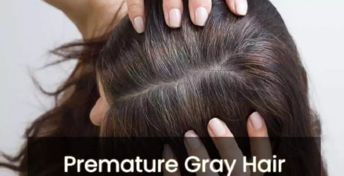 Premature Gray Hair