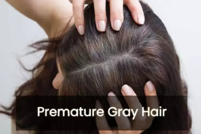 Premature Gray Hair
