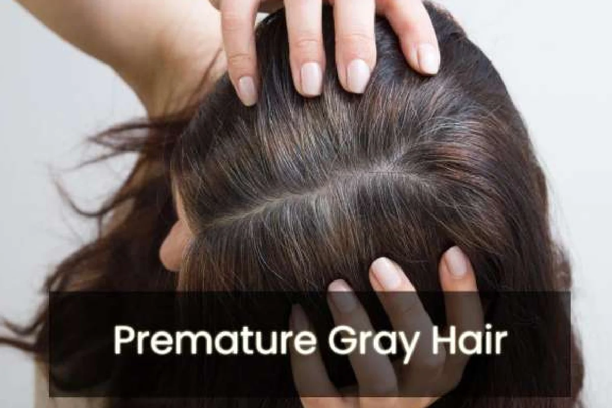 Premature Gray Hair