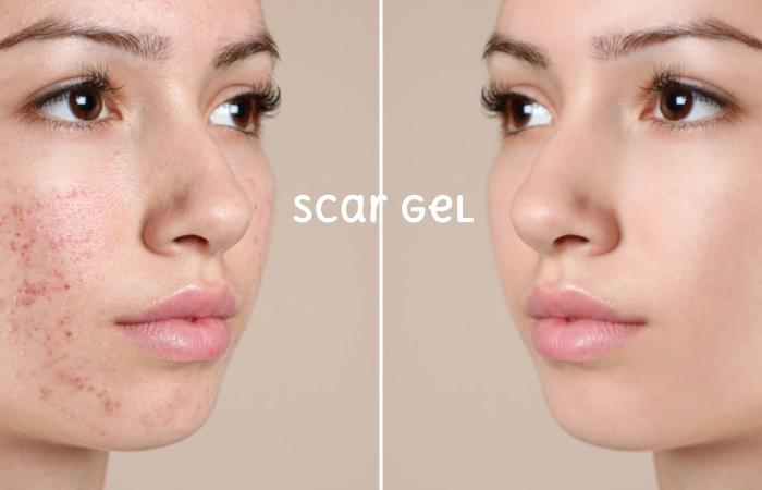 Scar Gel 