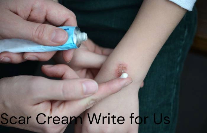 Scar Cream Write for Us