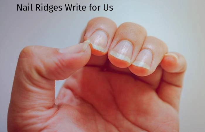 Nail Ridges Write for Us