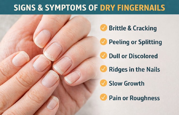 Signs and Symptoms of Dry Fingernails